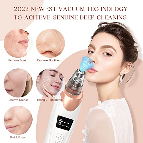 Pore Magic Vacuum